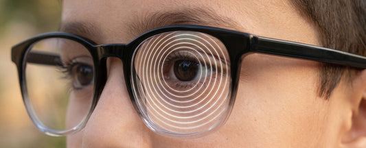What is Myopia? How can your child get affected with it?